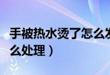 手被熱水燙了怎么發(fā)朋友圈（手被熱水燙了怎么處理）