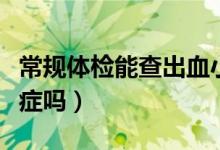 常規(guī)體檢能查出血小板嗎（常規(guī)體檢能查出癌癥嗎）
