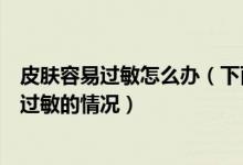 皮膚容易過敏怎么辦（下面教大家?guī)讉€小技巧能夠緩解皮膚過敏的情況）