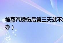 被蒸汽燙傷后第三天就不疼了會留疤嗎（被蒸汽燙傷后怎么辦）