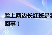 臉上兩邊長紅斑是怎么回事（臉上起紅斑怎么回事）