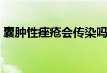 囊腫性痤瘡會(huì)傳染嗎（囊腫性痤瘡會(huì)自愈嗎）