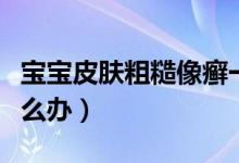 寶寶皮膚粗糙像癬一樣（寶寶皮膚粗糙像癬怎么辦）