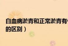 白血病淤青和正常淤青有什么不同（白血病淤青和正常淤青的區(qū)別）