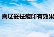 喜遼妥祛痘印有效果嗎（喜遼妥能去痘印嗎）