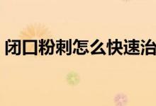 閉口粉刺怎么快速治療（閉口粉刺怎么治療）
