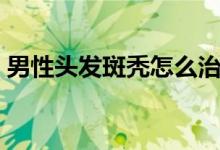 男性頭發(fā)斑禿怎么治療（頭發(fā)斑禿怎么治療）