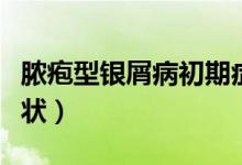 膿皰型銀屑病初期癥狀(頭皮型銀屑病初期癥狀)