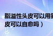 脂溢性頭皮可以用氨基酸洗發(fā)水嗎（脂溢性頭皮可以自愈嗎）