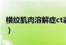 橫紋肌肉溶解癥ct表現(xiàn)（橫紋肌肉溶解癥前兆）