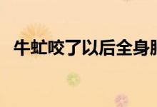 牛虻咬了以后全身腫脹（牛虻咬了怎么辦）