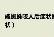 被蜘蛛咬人后癥狀圖片（蜘蛛咬到會(huì)有什么癥狀）