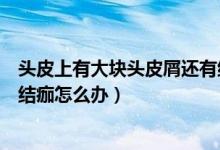頭皮上有大塊頭皮屑還有結痂怎么處理（頭皮有大塊頭皮屑結痂怎么辦）