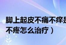 腳上起皮不痛不癢是怎么回事（腳底起皮不癢不疼怎么治療）