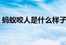 螞蟻咬人是什么樣子的（螞蟻咬人是否有毒）