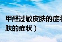 甲醛過敏皮膚的癥狀可以自愈嗎（甲醛過敏皮膚的癥狀）
