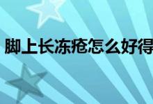 腳上長凍瘡怎么好得快（腳上長凍瘡的癥狀）