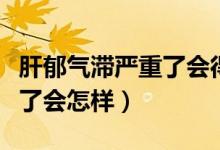 肝郁氣滯嚴(yán)重了會得抑郁癥嗎（肝郁氣滯嚴(yán)重了會怎樣）
