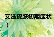 艾滋皮膚初期癥狀（艾滋皮膚初期癥狀有哪些）