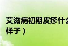 艾滋病初期皮疹什么樣(艾滋病初期皮疹什么樣子)