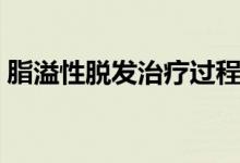 脂溢性脫發(fā)治療過(guò)程視頻（脂溢性脫發(fā)治療）