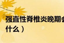 強(qiáng)直性脊椎炎晚期會(huì)癱瘓嗎（強(qiáng)直性脊椎炎是什么）