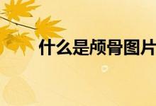 什么是顱骨圖片（什么是顱骨骨折）