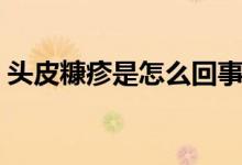頭皮糠疹是怎么回事（頭皮糠疹是怎么回事）