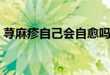 蕁麻疹自己會(huì)自愈嗎（蕁麻疹能自己自愈嗎）