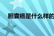 膽囊癌是什么樣的（dna是什么的縮寫(xiě)）