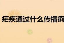 瘧疾通過什么傳播痢疾（瘧疾通過什么傳播）