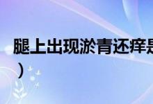 腿上出現(xiàn)淤青還癢是怎么回事（腿上出現(xiàn)淤青）