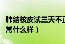 肺結核皮試三天不正常圖片（肺結核皮試不正常什么樣）