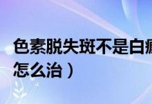 色素脫失斑不是白癜風能自愈嗎（色素脫失斑怎么治）