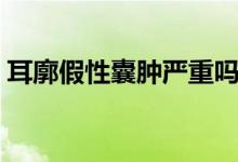 耳廓假性囊腫嚴重嗎（什么是耳廓假性囊腫）