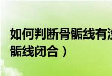 如何判斷骨骺線有沒(méi)有完全閉合(如何判斷骨骺線閉合)