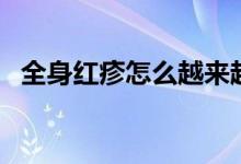 全身紅疹怎么越來越多（全身紅疹怎么治）