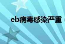 eb病毒感染嚴(yán)重(EB病毒感染嚴(yán)重嗎)