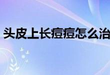 頭皮上長痘痘怎么治（頭皮上長痘痘怎么辦）
