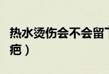 熱水燙傷會不會留下疤痕（熱水燙傷會不會留疤）