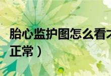 胎心監(jiān)護圖怎么看才過關（胎心監(jiān)護圖怎么看正常）